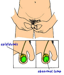 diagram showing testicular examination